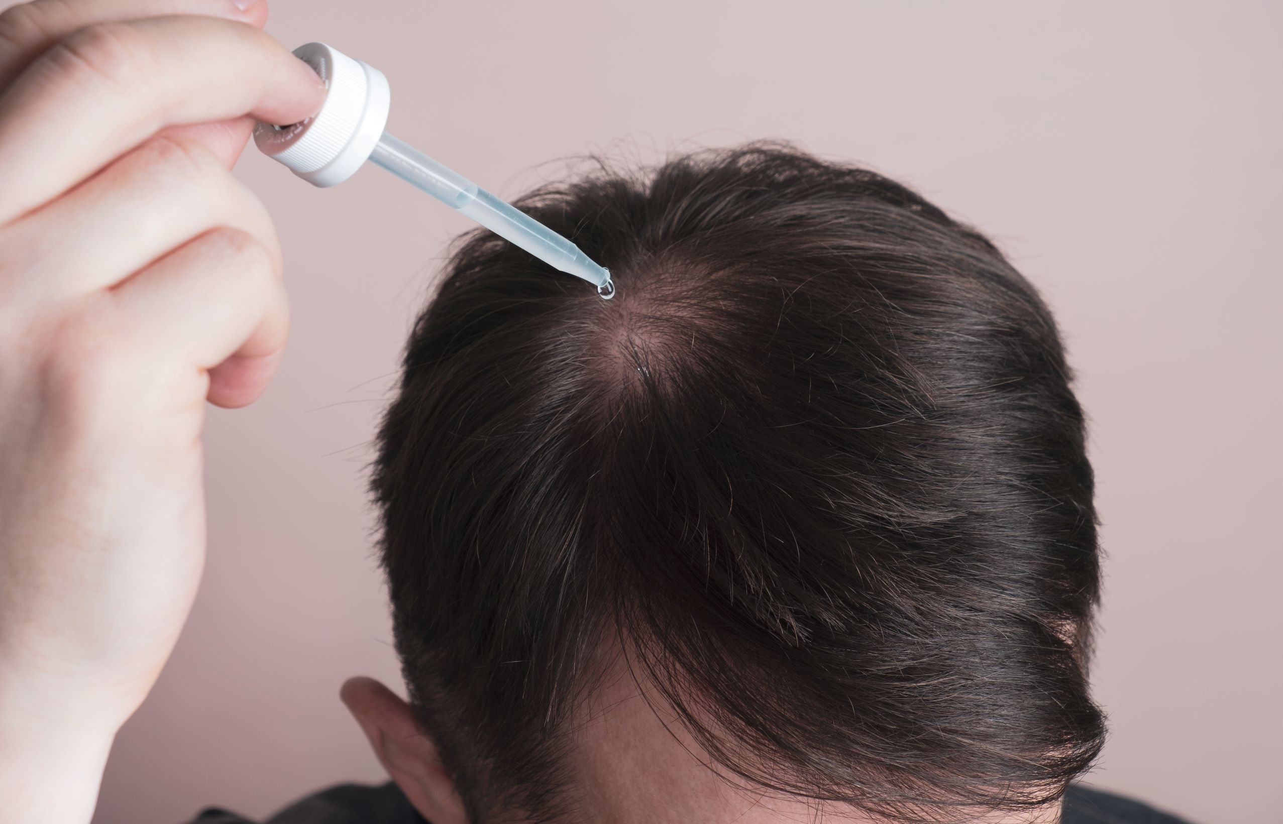 stop hair thinning