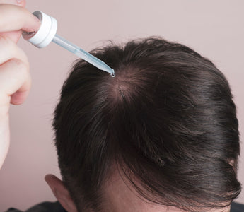 Why Minoxidil in 2024 remains the GOLD standard for treating hair loss